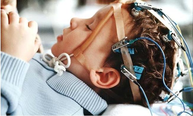 Epilepszia egy gyermekben: a betegség jellemzői és a betegség kezelése